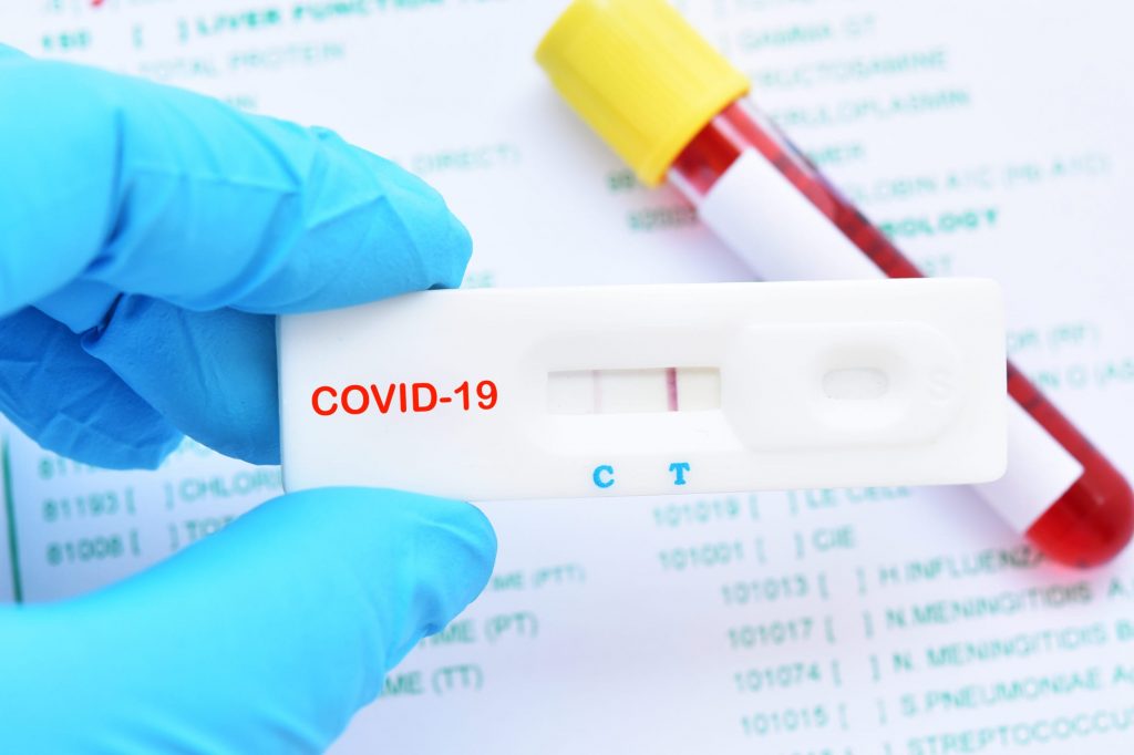 what happens if you test positive for covid antibodies