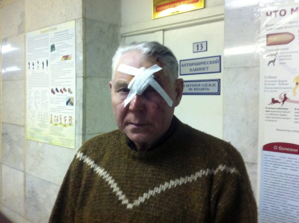an old man hit by a meteorite piece