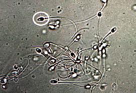 human sperm cells