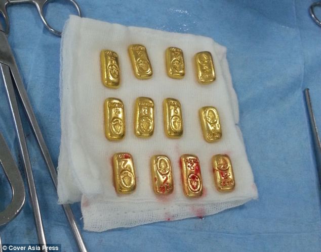 12 gold bars found in body of Indian businessman, strange news, 12 gold bars found in body of Indian businessman. Photo: The Indian Express, india man swallows gold bars, strange news: indian man swallows gold bars, weird news: indian businessman swallows gold bars, surprising news: indian man swallows gold bars, strange human behavior: 12 gold bars recovered from indian man stomach, weird news, strange things around the world, strange things india, 