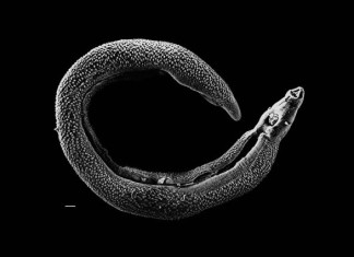 Schistosoma, Parasitic schistosoma worm. Photo: David Williams, Adult male schistosoma, Parasitic Worm Discovered In Ancient Tomb, The question of when and where schistosomes first started to cause disease in our ancestors is, however, still unanswered,