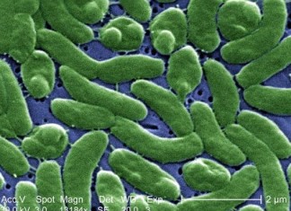 flesh-eating bacteria florida july 2014, deadly bacteria florida, plague bacteria florida 2014, flesh-eating bacteria florida 20014, deadly plague of flesh-eating bacteria florida 2014, Vibrio vulnificus (flesh-eating bacteria) has now invaded Florida waters. Photo: Wikipedia Common