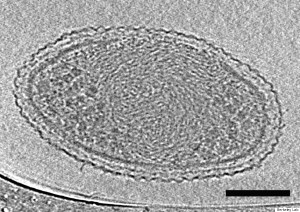 ultra-small bacteria, ultra-small bacteria photo, photo of ultra-small bacteria, Tiniest life forms on Earth discovered and photographed for the first time , The tiniest life forms on Earth have been recently discovered and photographed for the first time. They are so-called ultra-small bacteria., The tiniest life forms on Earth have been recently discovered and photographed for the first time. They are so-called ultra-small bacteria.