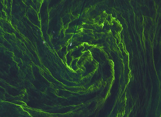 Eye algal storm, eye of an algal storm, eye of an algae bloom, algae bloom baltic sea, algae bloom looks like hurricane