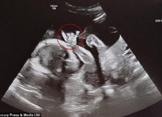 unborn baby devil horns, unborn baby devil horns picture, Scan shows unborn baby making heavy metal devil horns gesture
