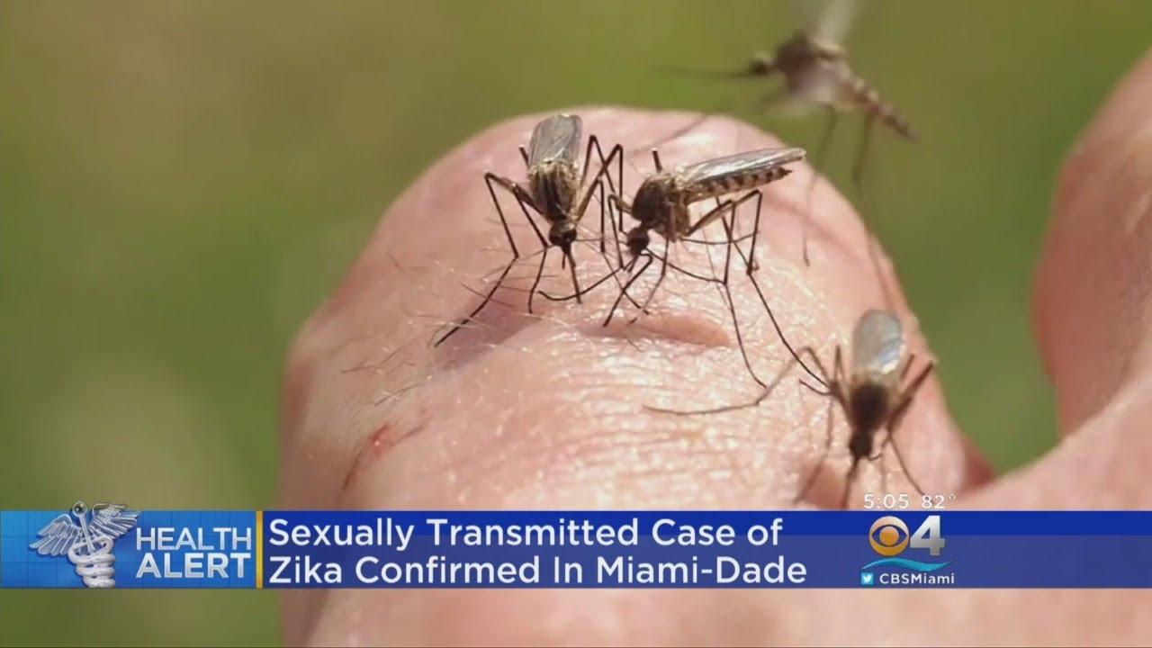 first sexually transmitted case of Zika confirmed in Miami, first sexually transmitted case of Zika confirmed in Miami video, first sexually transmitted case of Zika confirmed in Miami-dade, first sexually transmitted case of Zika confirmed in Miami-dade video