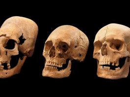 mystery alien elongated skulls bavaria, alien skulls mystery bavaria, mystery alien skulls bavaria, elongated skulls bavaria