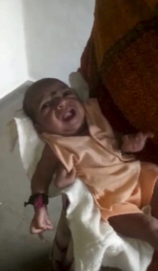 A baby girl born with three hands is now worshipped as a god in India, A baby girl born with three hands is now worshipped as a god in India pictures, A baby girl born with three hands is now worshipped as a god in India video, A baby girl born with three hands is now worshipped as a god in India november 2018, A baby girl born with three hands is now worshipped as a god in India december 2018