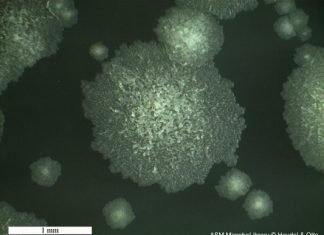 Buruli ulcer,Mycobacterium ulcerans, A flesh-eating bacterium is spreading in Australia