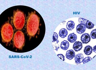 HIV positive after Covid vaccine