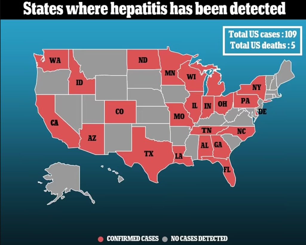 States where mysterious children hepatitis has been detected in the US