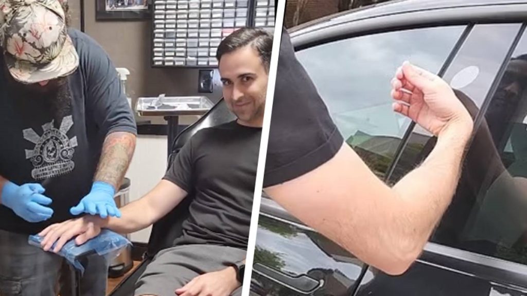 Man implants Tesla key into skin to unlock car by raising hand