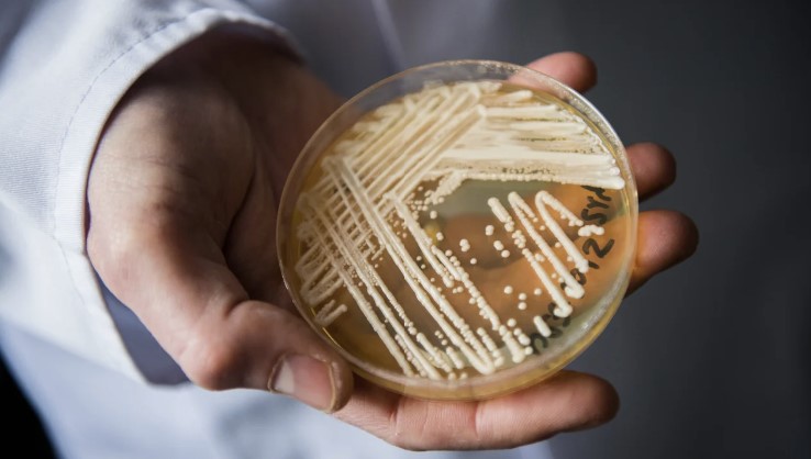 An emerging fungal threat spread at an alarming rate in US health care facilities