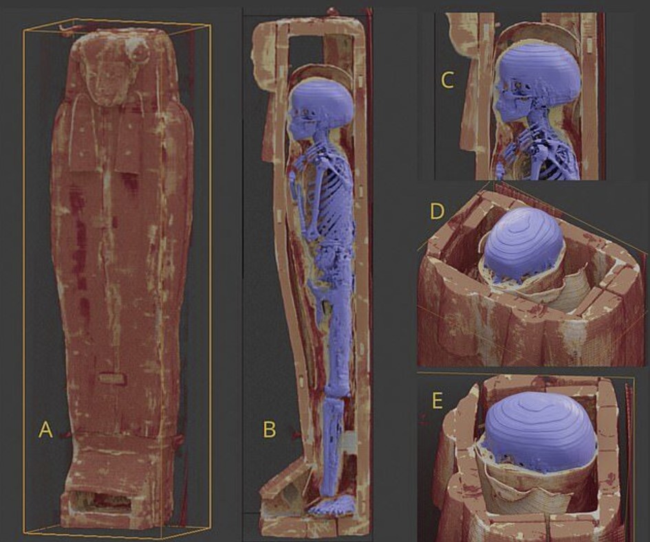 Egyptian ancient mummy with abnormally large brain discovered